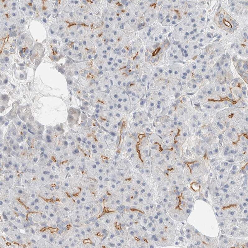 Adipolin/FAM132A Antibody - BSA Free Immunohistochemistry: Adipolin/FAM132A Antibody - BSA Free [NBP1-90700]