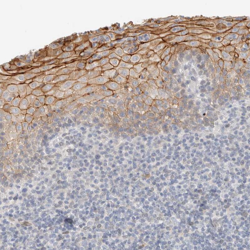 Adipolin/FAM132A Antibody - BSA Free Immunohistochemistry: Adipolin/FAM132A Antibody - BSA Free [NBP1-90700]