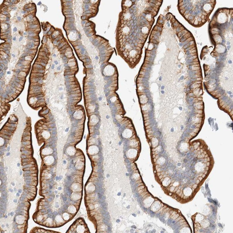 Adipolin/FAM132A Antibody - BSA Free Immunohistochemistry: Adipolin/FAM132A Antibody - BSA Free [NBP1-90700]