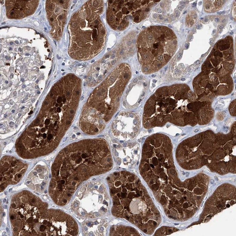 AKNAD1 Antibody - BSA Free Immunohistochemistry: AKNAD1 Antibody - BSA Free [NBP1-90704]
