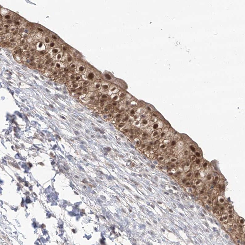 BROX Antibody - BSA Free Immunohistochemistry-Paraffin: BROX Antibody [NBP1-90706]