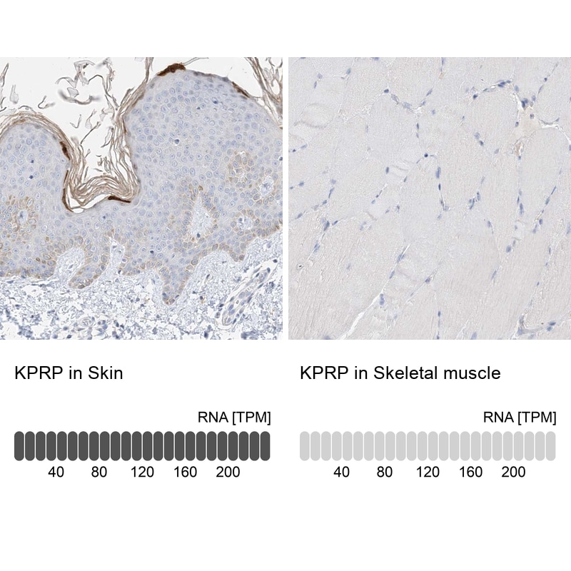 KPRP Antibody - BSA Free Immunohistochemistry: KPRP Antibody - BSA Free [NBP1-90707]