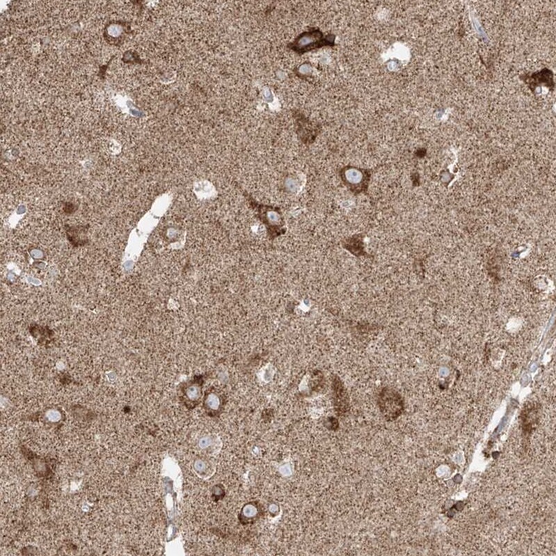 GLT25D2 Antibody - BSA Free Immunohistochemistry: GLT25D2 Antibody - BSA Free [NBP1-90711]