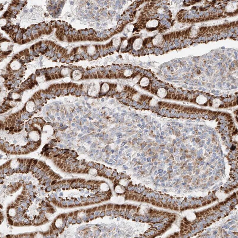 GLT25D2 Antibody - BSA Free Immunohistochemistry: GLT25D2 Antibody - BSA Free [NBP1-90711]