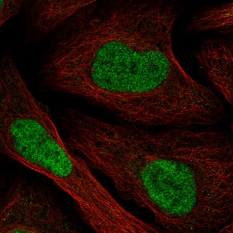 TMEM69 Antibody - BSA Free Immunocytochemistry/ Immunofluorescence: TMEM69 Antibody [NBP1-90713]