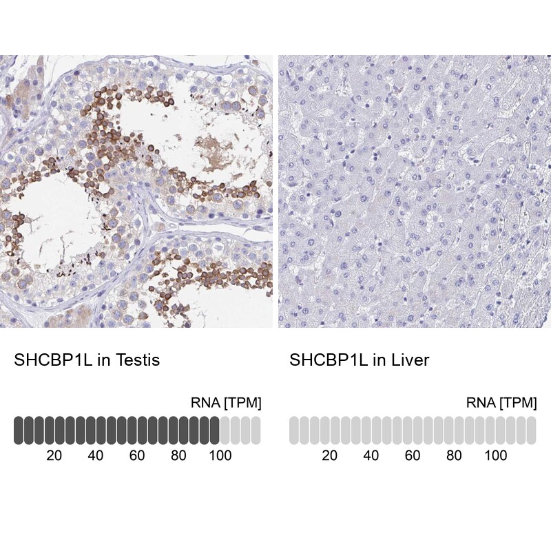 SHCBP1L Antibody - BSA Free Immunohistochemistry: SHCBP1L Antibody - BSA Free [NBP1-90716]