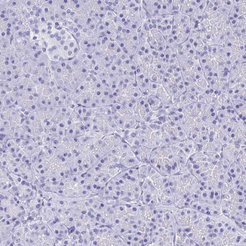 SHCBP1L Antibody - BSA Free Immunohistochemistry: SHCBP1L Antibody - BSA Free [NBP1-90716]