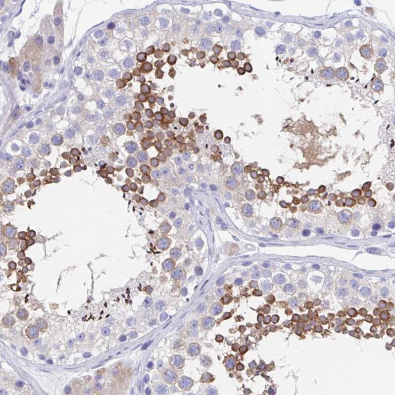 SHCBP1L Antibody - BSA Free Immunohistochemistry: SHCBP1L Antibody - BSA Free [NBP1-90716]