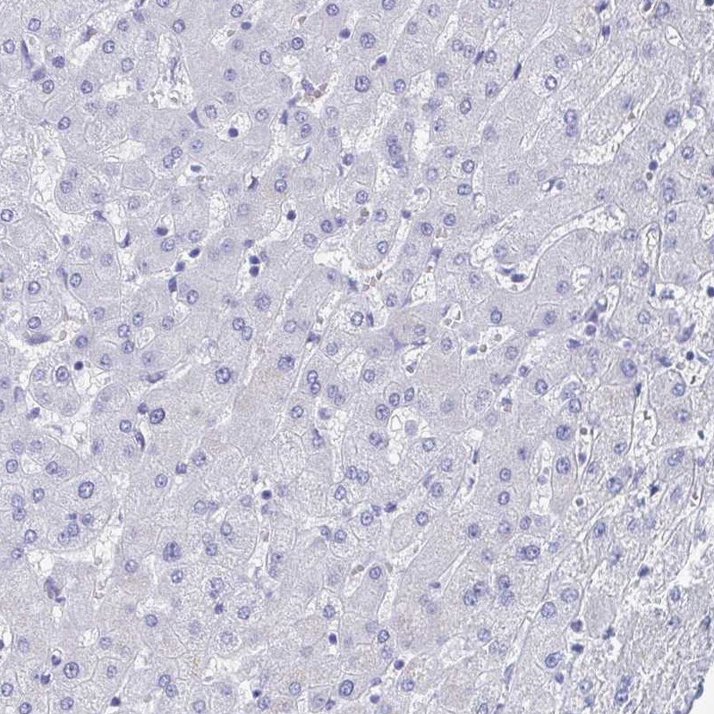 SHCBP1L Antibody - BSA Free Immunohistochemistry: SHCBP1L Antibody - BSA Free [NBP1-90716]