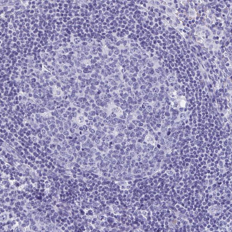 SHCBP1L Antibody - BSA Free Immunohistochemistry: SHCBP1L Antibody - BSA Free [NBP1-90716]
