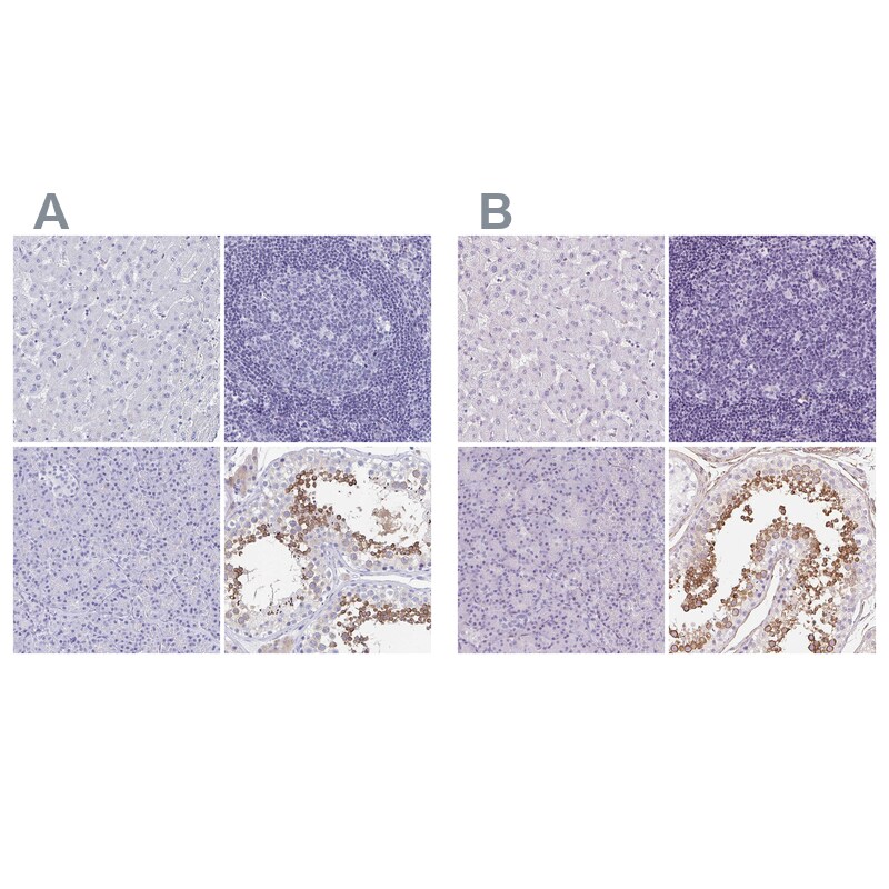 SHCBP1L Antibody - BSA Free Immunohistochemistry: SHCBP1L Antibody - BSA Free [NBP1-90716]
