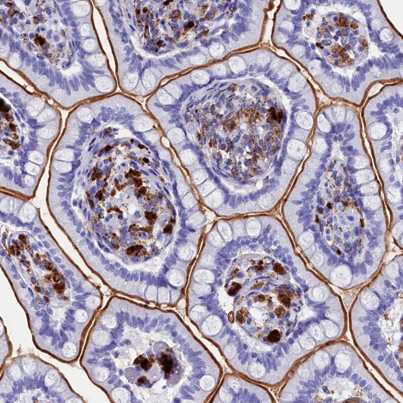 PLAC8 Antibody - BSA Free Immunohistochemistry: PLAC8 Antibody - BSA Free [NBP1-90721]