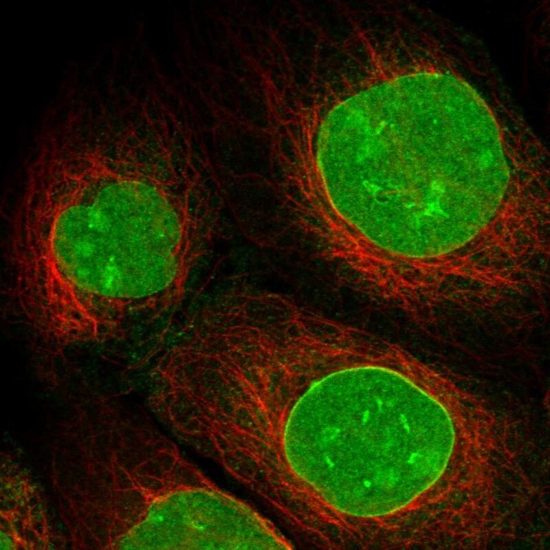 SAMD15 Antibody - BSA Free Immunocytochemistry/ Immunofluorescence: SAMD15 Antibody [NBP1-90727]