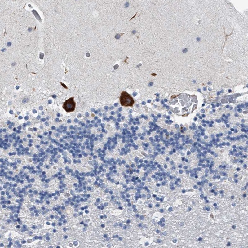 TMEM63C Antibody - BSA Free Immunohistochemistry: TMEM63C Antibody - BSA Free [NBP1-90728]
