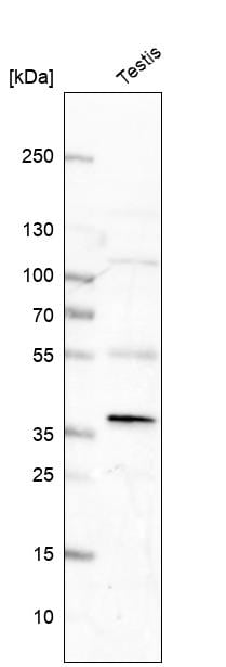 FAM181A Antibody - BSA Free Western Blot: FAM181A Antibody - BSA Free [NBP1-90730]