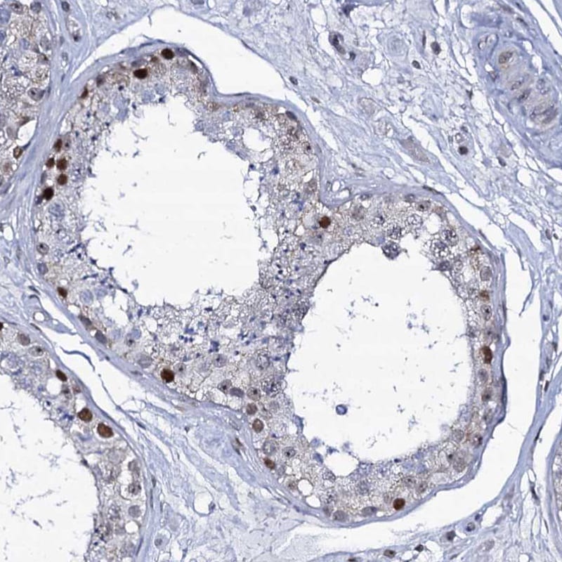 MCMBP Antibody - BSA Free Immunohistochemistry-Paraffin: MCMBP Antibody [NBP1-90746]