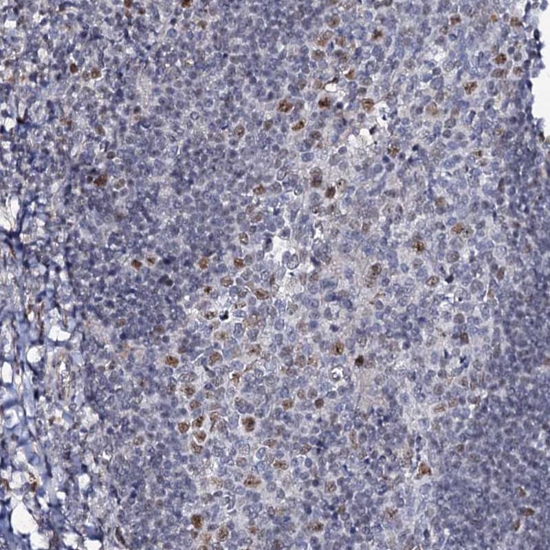 MCMBP Antibody - BSA Free Immunohistochemistry-Paraffin: MCMBP Antibody [NBP1-90746]