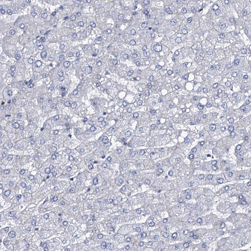 MCMBP Antibody - BSA Free Immunohistochemistry-Paraffin: MCMBP Antibody [NBP1-90746]