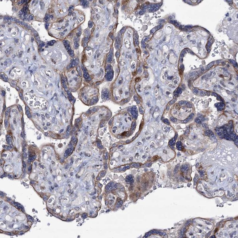MCMBP Antibody - BSA Free Immunohistochemistry-Paraffin: MCMBP Antibody [NBP1-90746]