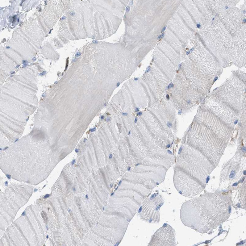 CD277/BTN3A1 Antibody - BSA Free Immunohistochemistry: CD277/BTN3A1 Antibody - BSA Free [NBP1-90750]