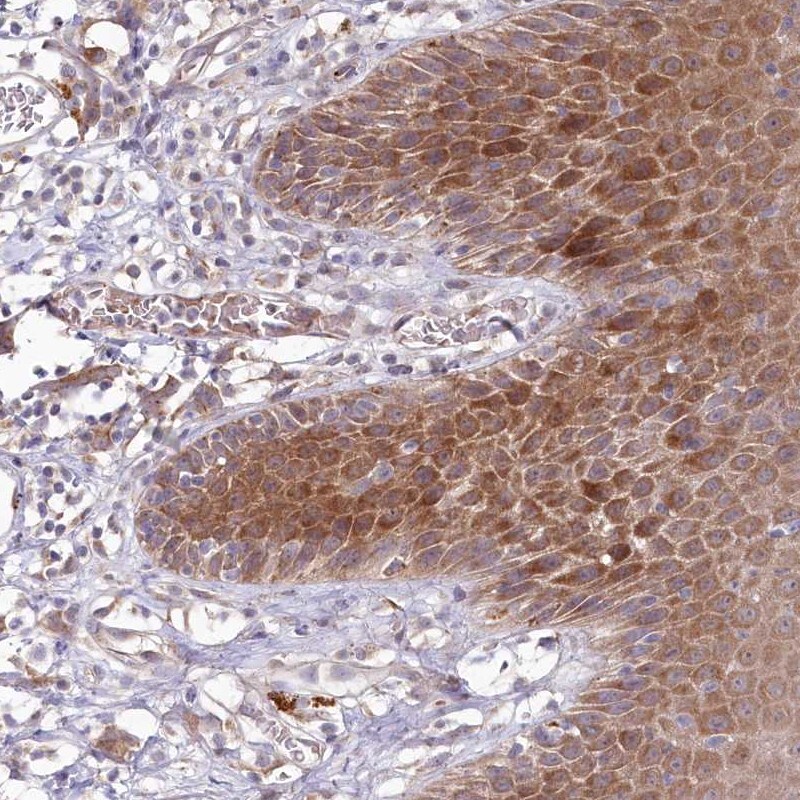 BPIL2 Antibody - BSA Free Immunohistochemistry-Paraffin: BPIL2 Antibody [NBP1-90753]