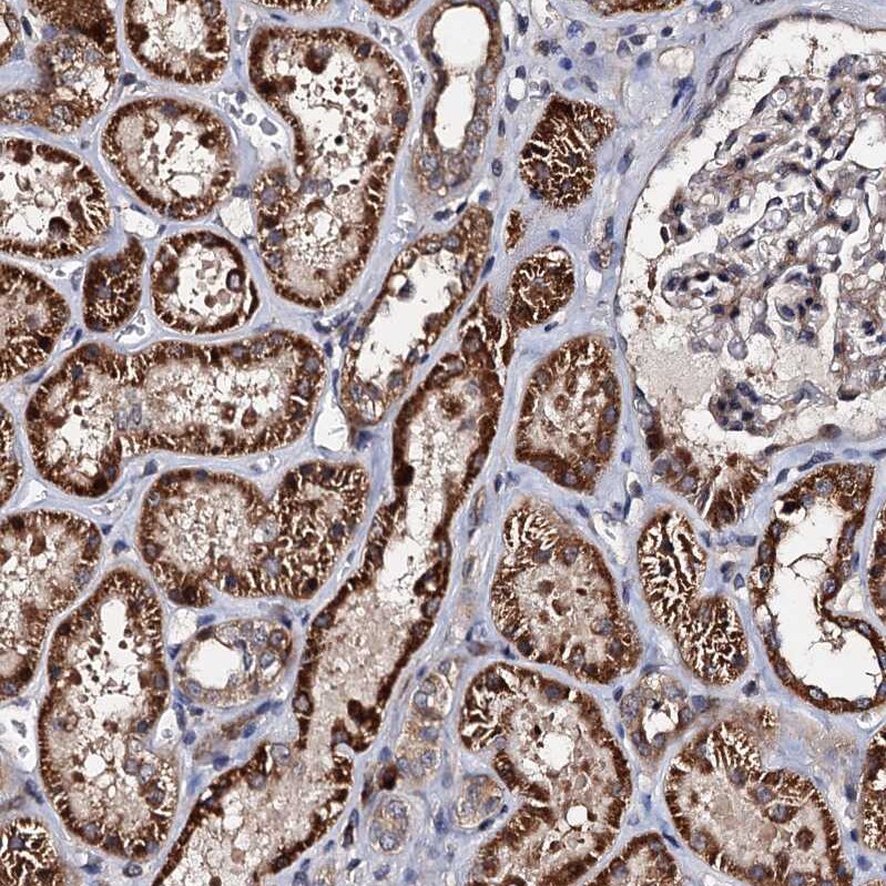 WWC3 Antibody - BSA Free Immunohistochemistry: WWC3 Antibody - BSA Free [NBP1-90755]