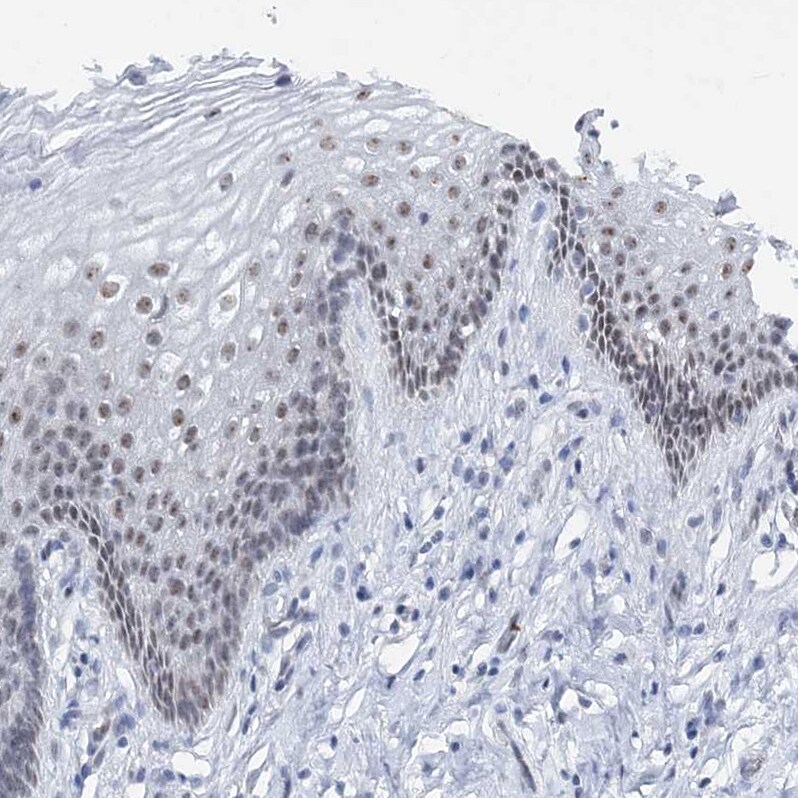 ASCL4 Antibody - BSA Free Immunohistochemistry-Paraffin: ASCL4 Antibody [NBP1-90762]