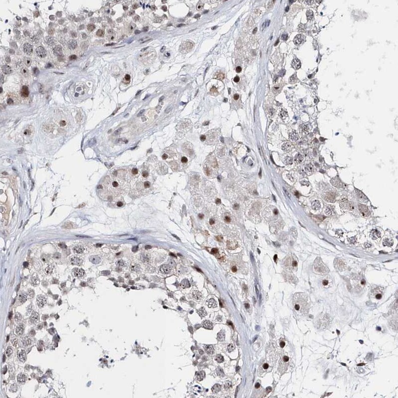 ASCL4 Antibody - BSA Free Immunohistochemistry-Paraffin: ASCL4 Antibody [NBP1-90762]