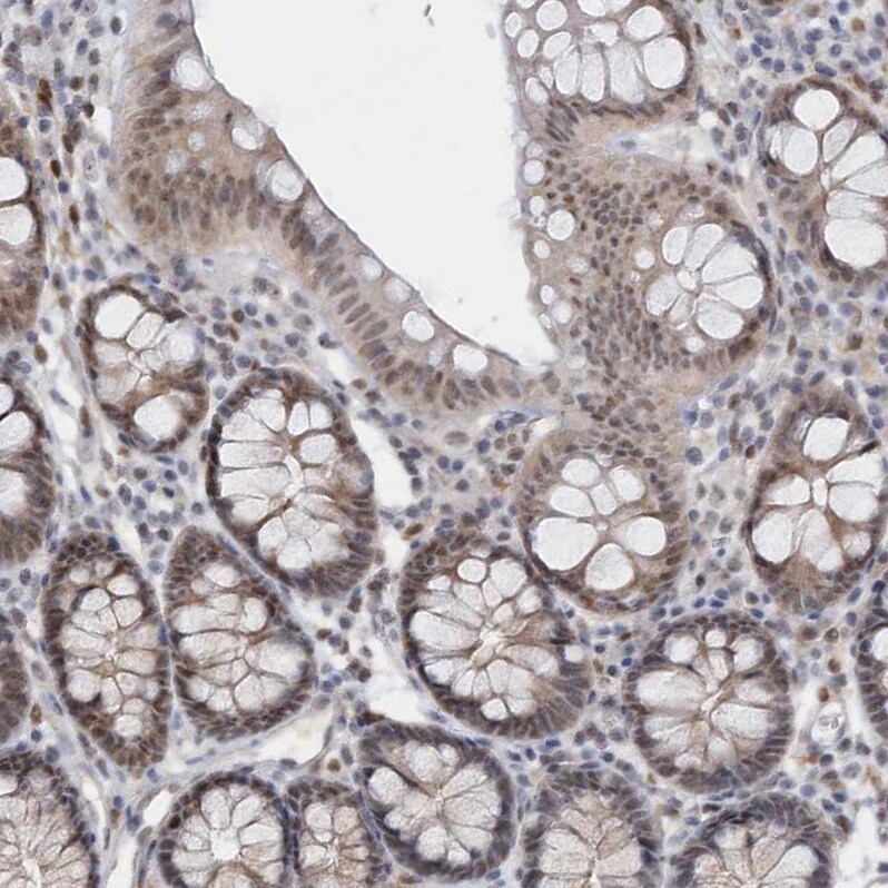 ASCL4 Antibody - BSA Free Immunohistochemistry-Paraffin: ASCL4 Antibody [NBP1-90762]
