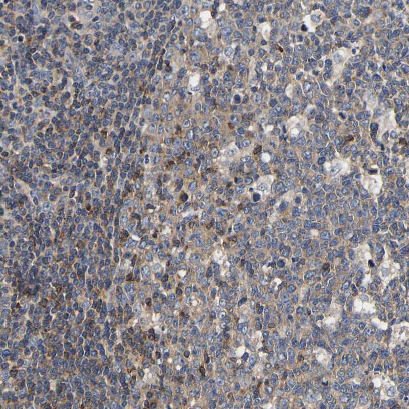 LRBA Antibody - BSA Free Immunohistochemistry: LRBA Antibody - BSA Free [NBP1-90765]