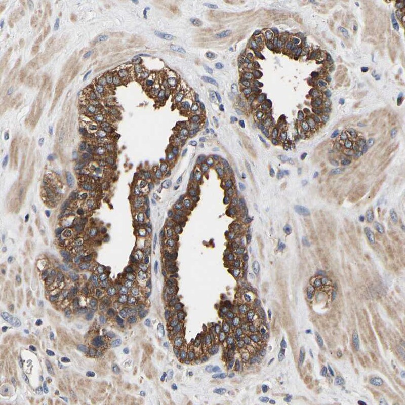 LRBA Antibody - BSA Free Immunohistochemistry: LRBA Antibody - BSA Free [NBP1-90765]