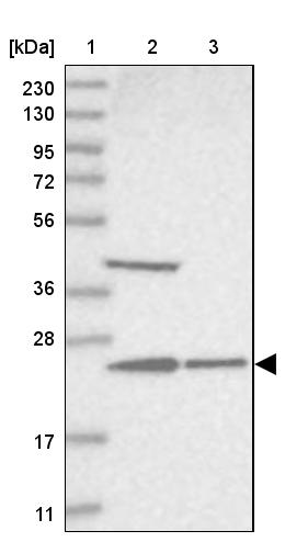 UQCC Antibody - BSA Free Western Blot: UQCC Antibody - BSA Free [NBP1-90766]