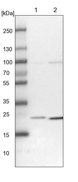 UQCC Antibody - BSA Free Western Blot: UQCC Antibody - BSA Free [NBP1-90766]