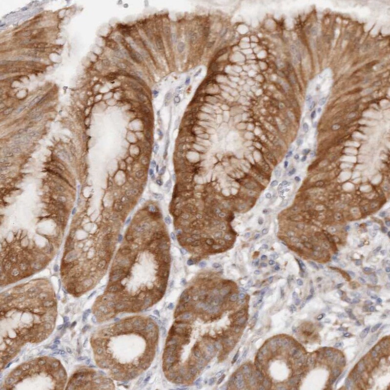 BCL2L15 Antibody - BSA Free Immunohistochemistry: BCL2L15 Antibody - BSA Free [NBP1-90767]