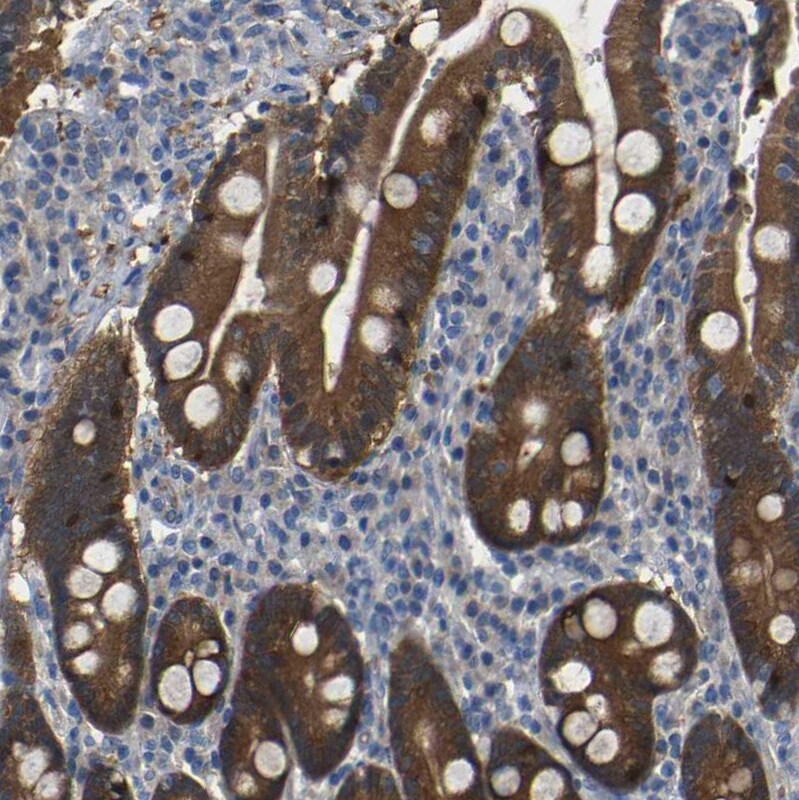 TBC1D32 Antibody - BSA Free Immunohistochemistry: TBC1D32 Antibody - BSA Free [NBP1-90777]