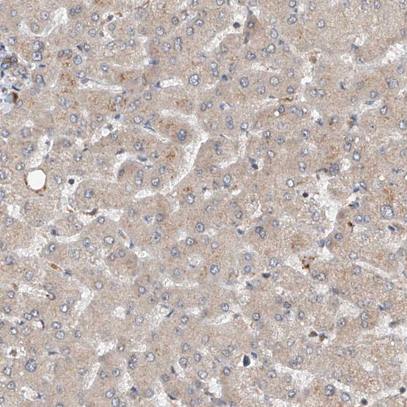 CEP85L Antibody - BSA Free Immunohistochemistry: CEP85L Antibody - BSA Free [NBP1-90778]