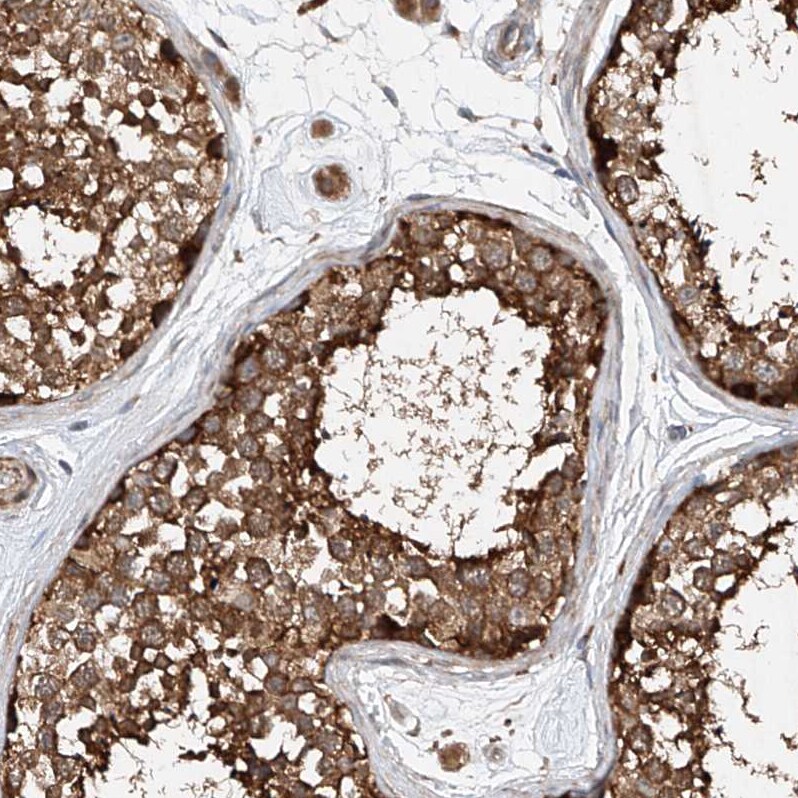 CEP85L Antibody - BSA Free Immunohistochemistry: CEP85L Antibody - BSA Free [NBP1-90778]
