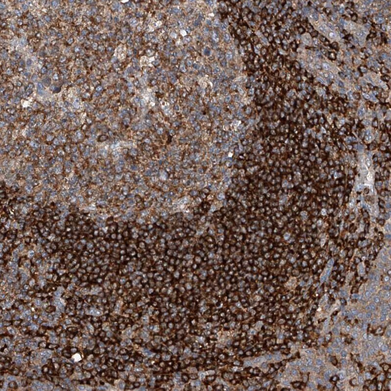 CEP85L Antibody - BSA Free Immunohistochemistry: CEP85L Antibody - BSA Free [NBP1-90778]