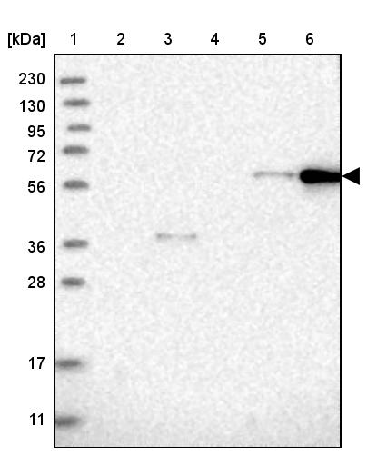 CEP85L Antibody - BSA Free Western Blot: CEP85L Antibody - BSA Free [NBP1-90778]