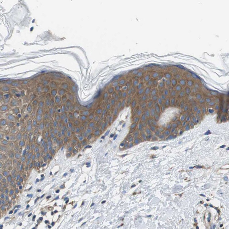 DENND4C Antibody - BSA Free Immunohistochemistry: DENND4C Antibody - BSA Free [NBP1-90788]