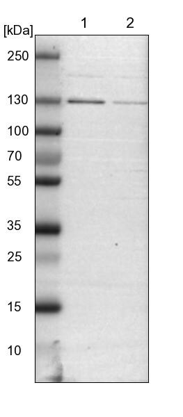 DENND4C Antibody - BSA Free Western Blot: DENND4C Antibody - BSA Free [NBP1-90788]