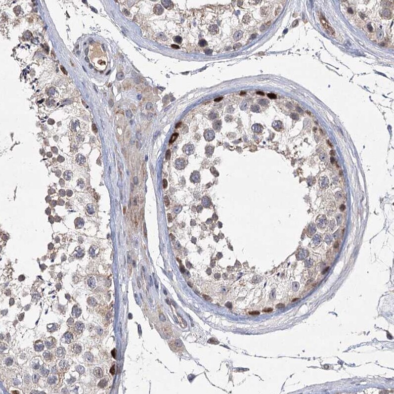 NSMCE4A Antibody - BSA Free Immunohistochemistry: NSMCE4A Antibody - BSA Free [NBP1-90789]