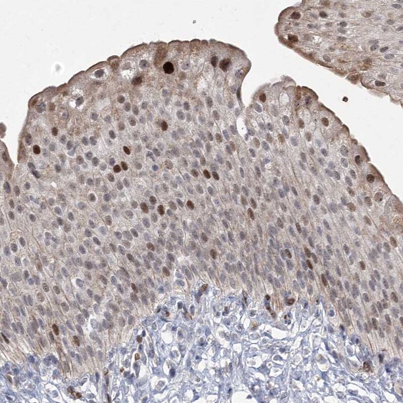 NSMCE4A Antibody - BSA Free Immunohistochemistry: NSMCE4A Antibody - BSA Free [NBP1-90789]