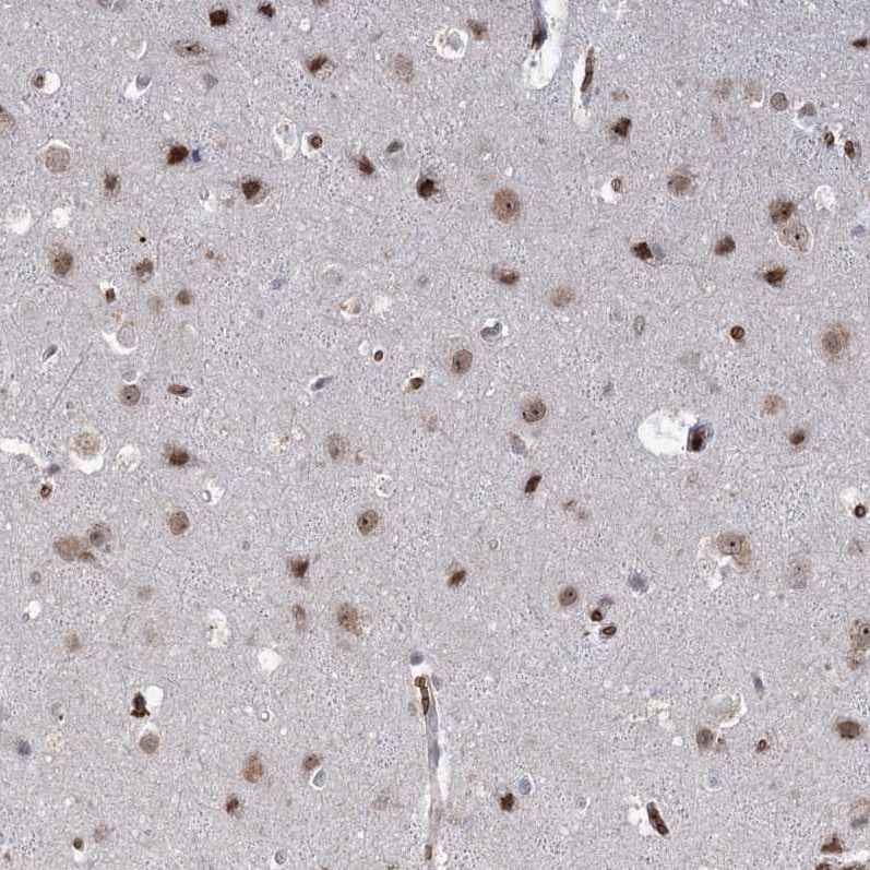 NSMCE4A Antibody - BSA Free Immunohistochemistry: NSMCE4A Antibody - BSA Free [NBP1-90789]