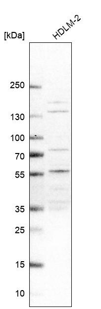 NSMCE4A Antibody - BSA Free Western Blot: NSMCE4A Antibody - BSA Free [NBP1-90789]