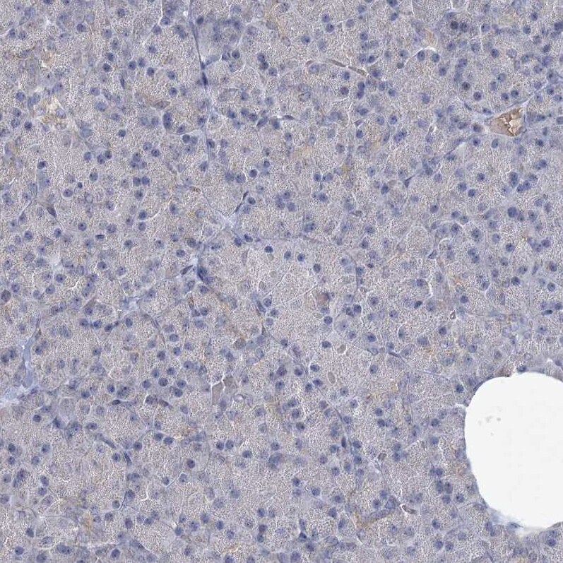 NSMCE4A Antibody - BSA Free Immunohistochemistry: NSMCE4A Antibody - BSA Free [NBP1-90789]