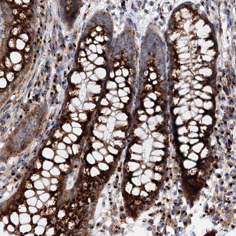 FAM48A Antibody - BSA Free Immunohistochemistry-Paraffin: FAM48A Antibody [NBP1-90795]