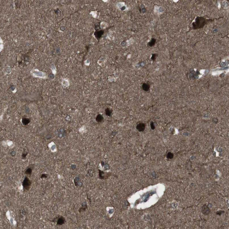 SLITRK5 Antibody - BSA Free Immunohistochemistry: SLITRK5 Antibody - BSA Free [NBP1-90798]