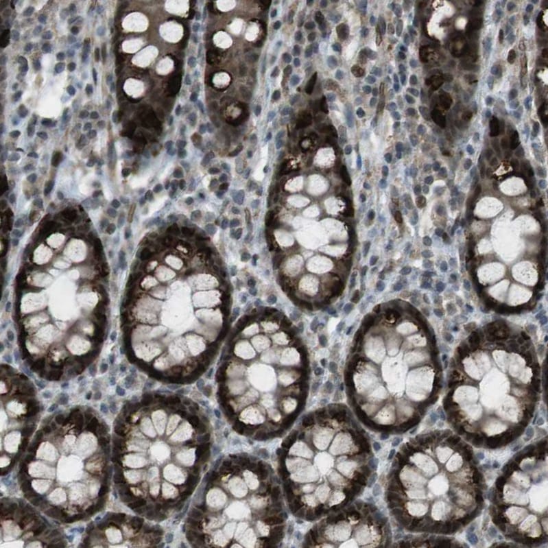 SLITRK5 Antibody - BSA Free Immunohistochemistry: SLITRK5 Antibody - BSA Free [NBP1-90798]