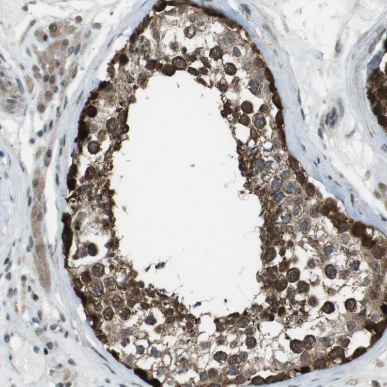 SLITRK5 Antibody - BSA Free Immunohistochemistry: SLITRK5 Antibody - BSA Free [NBP1-90798]